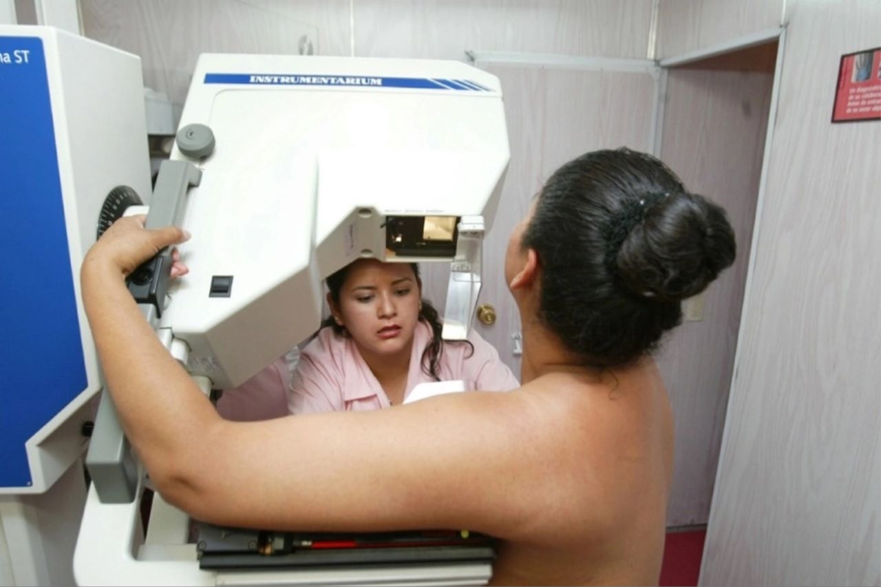 Foto de un estudio de prevención de cáncer de mamá, que puedes realizarte en Toluca.